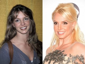 Britney Spears before and after plastic surgery 10