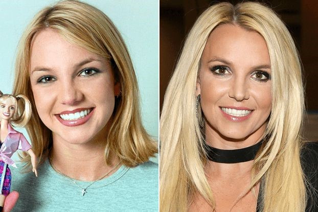 Britney Spears before and after plastic surgery