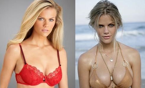 Brooklyn Decker plastic surgery and new hair style! 