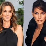 Cindy Crawford before and after plastic surgery 01