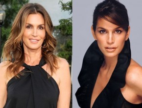 Cindy Crawford before and after plastic surgery 01