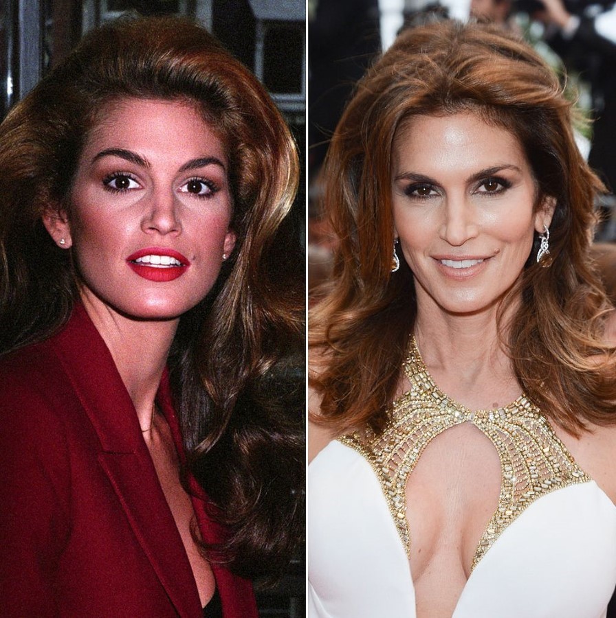 Cindy Crawford before and after plastic surgery