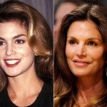 Cindy Crawford before and after plastic surgery 03