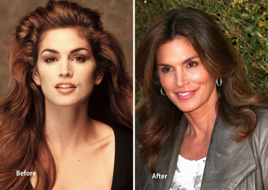 Cindy Crawford before and after plastic surgery