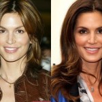 Cindy Crawford before and after plastic surgery 05