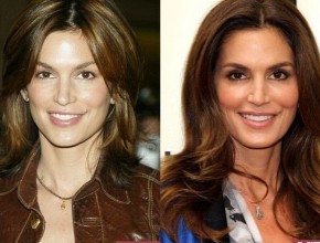 Cindy Crawford before and after plastic surgery 05