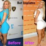 Coco Austin before and after plastic surgery 01
