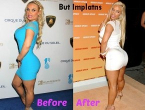 Coco Austin before and after plastic surgery 01