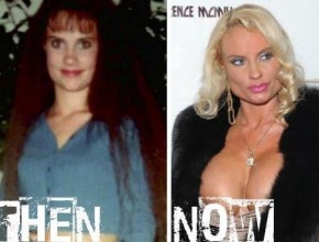 Coco Austin before and after plastic surgery 02