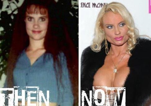 Coco Austin before and after plastic surgery 02