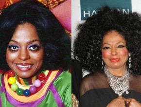 Diana Ross before and after plastic surgery