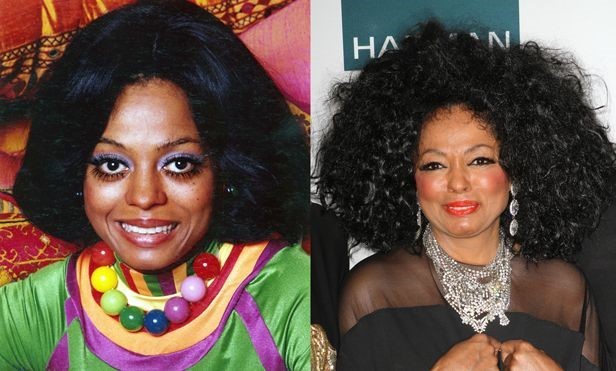 Diana Ross before and after plastic surgery