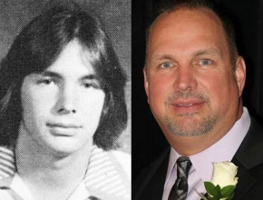 Garth Brooks before and after plastic surgery 01