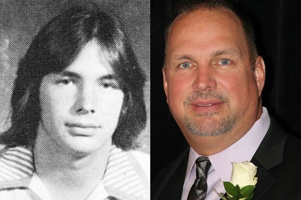 Garth Brooks before and after plastic surgery