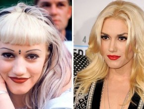 Gwen Stefani before and after plastic surgery 01