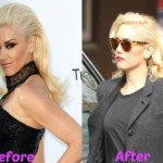 Gwen Stefani before and after plastic surgery 02