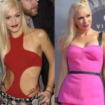 Gwen Stefani before and after plastic surgery 03