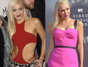 Gwen Stefani before and after plastic surgery 03