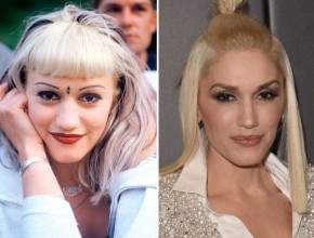 Gwen Stefani before and after plastic surgery