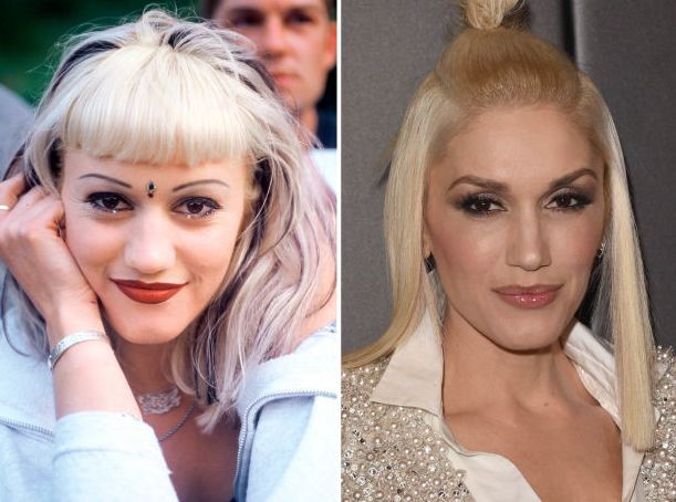 Gwen Stefani before and after plastic surgery