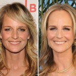 Helen Hunt before and after plastic surgery 02
