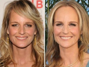 Helen Hunt before and after plastic surgery 02