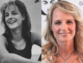 Helen Hunt before and after plastic surgery 04