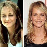 Helen Hunt before and after plastic surgery 07