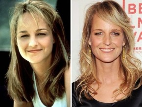 Helen Hunt before and after plastic surgery 07