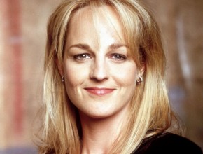 Helen Hunt plastic surgery 04