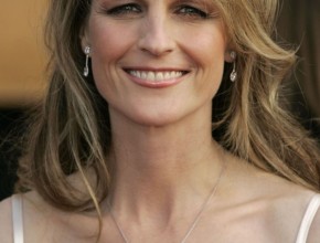 Helen Hunt plastic surgery 08