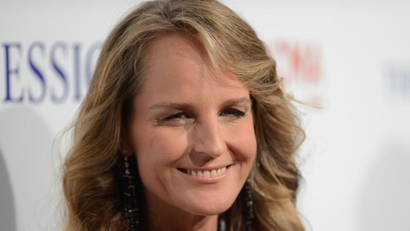 Helen Hunt plastic surgery