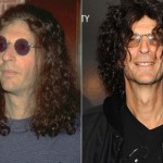 Howard Stern before and after plastic surgery 01