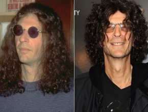 Howard Stern before and after plastic surgery 01