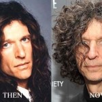 Howard Stern before and after plastic surgery 04