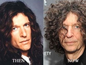 Howard Stern before and after plastic surgery 04
