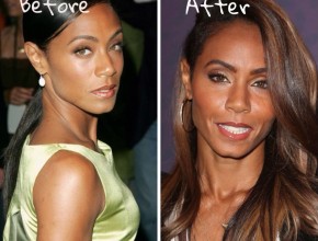 Jada Pinkett Smith before and after plastic surgery