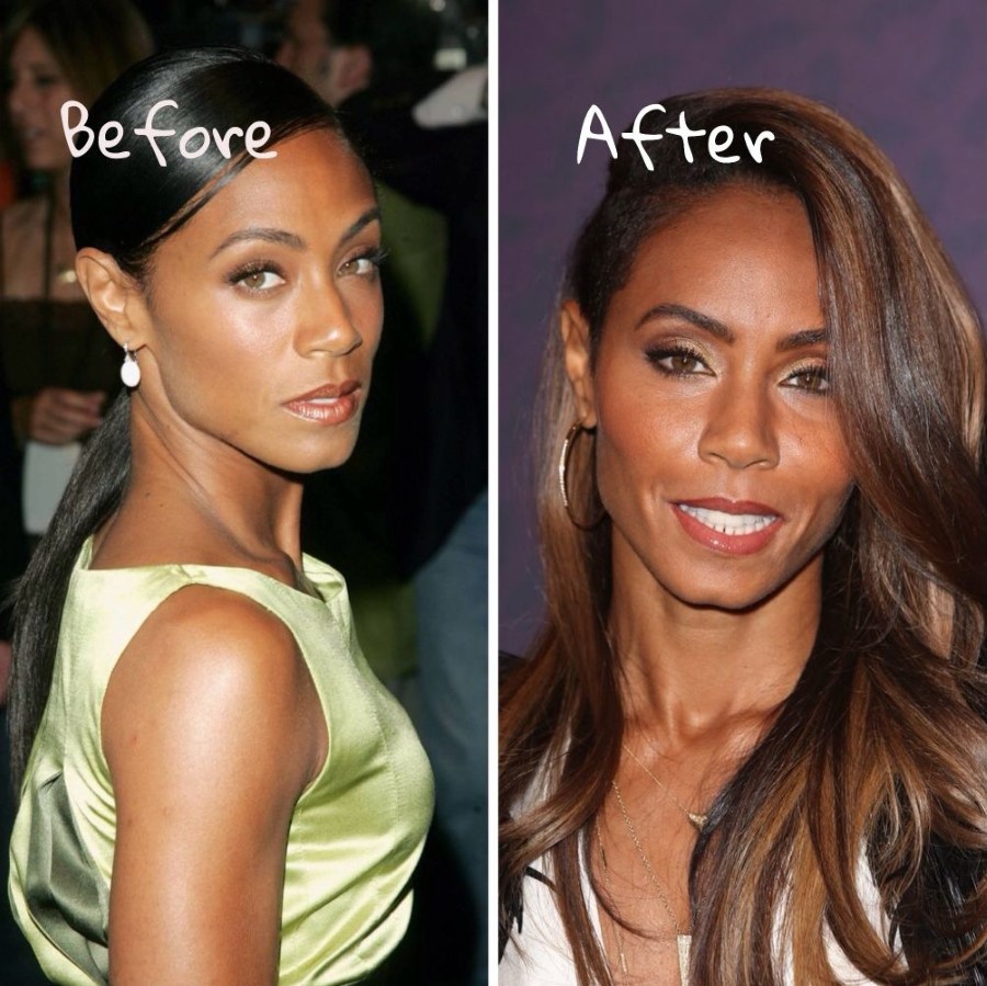 Jada Pinkett Smith before and after plastic surgery