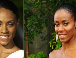 Jada Pinkett Smith before and after plastic surgery 01