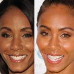 Jada Pinkett Smith before and after plastic surgery 03