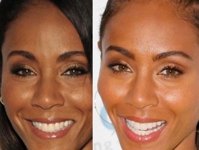 Jada Pinkett Smith before and after plastic surgery 03