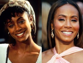 Jada Pinkett Smith before and after plastic surgery 04