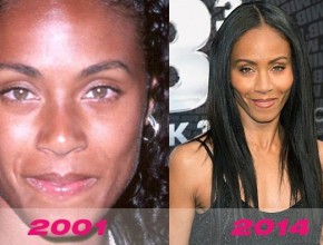 Jada Pinkett Smith before and after plastic surgery 05