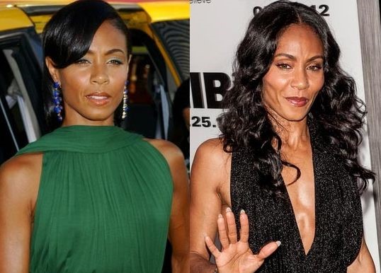 Jada Pinkett Smith before and after plastic surgery