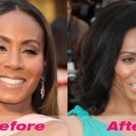 Jada Pinkett Smith before and after plastic surgery 07