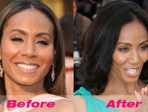 Jada Pinkett Smith before and after plastic surgery 07