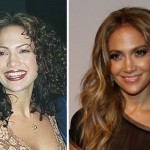 Jennifer Lopez before and after plastic surgery 03