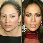 Jennifer Lopez before and after plastic surgery 04