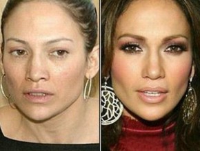 Jennifer Lopez before and after plastic surgery 04