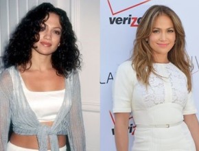 Jennifer Lopez before and after plastic surgery 05